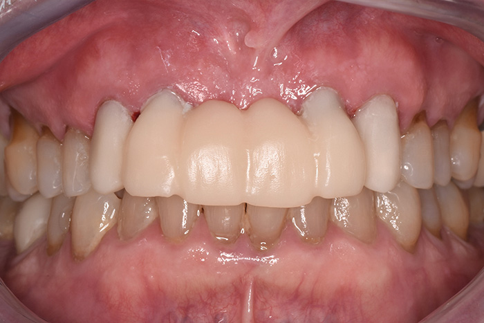 Before After Dental Photos Before and After | BayView Dental Arts