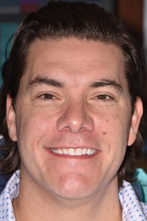 Before After Dental Photos Before and After | BayView Dental Arts