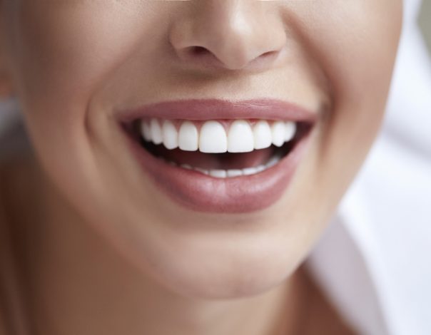 Woman's teeth