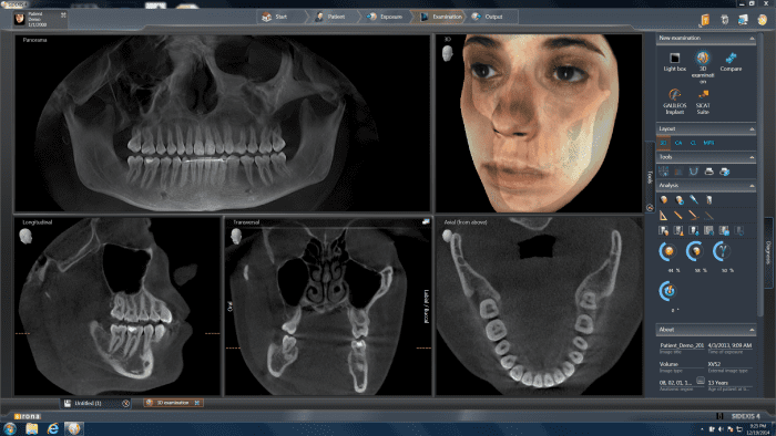 GiANO HR Extraoral Imaging in Naples, FL